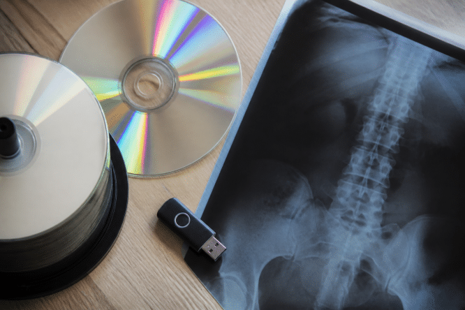 CD DVD cles USB et radiographie medicale